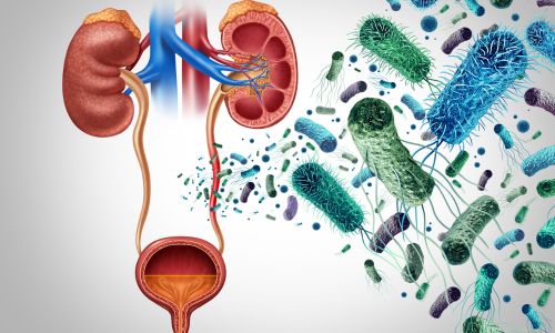 Harnleiterentzündung (Ureteritis)