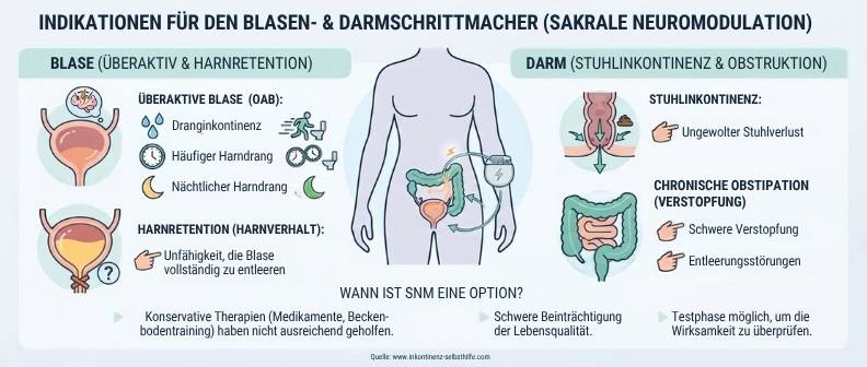 Sakrale Neuromodulation